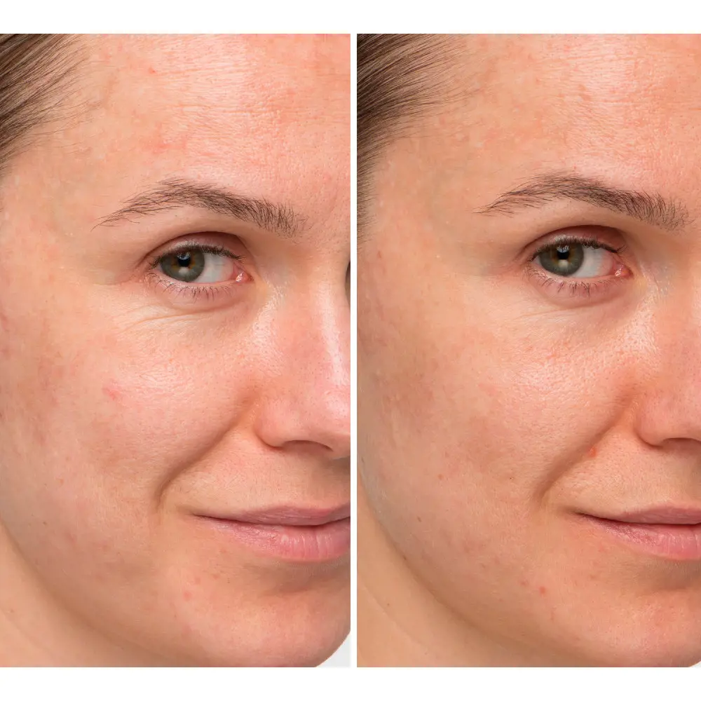 Kem Dưỡng Da IT Cosmetics CONFIDENCE in a Cream 2 CONFIDENCE in a cream Kem chống lão hóa & Điều trị chống nhăn chính hãng IT Cosmetics